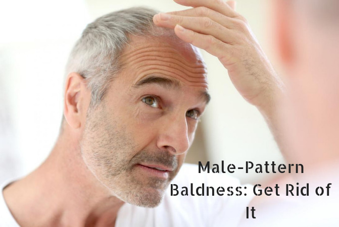 Male-Pattern Baldness_ Get Rid of It